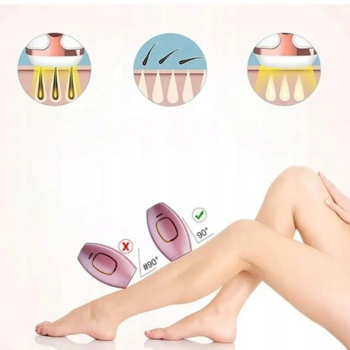 Lazerinis plaukų šalinimo aparatas kūnui, kojoms ir bikini zonai