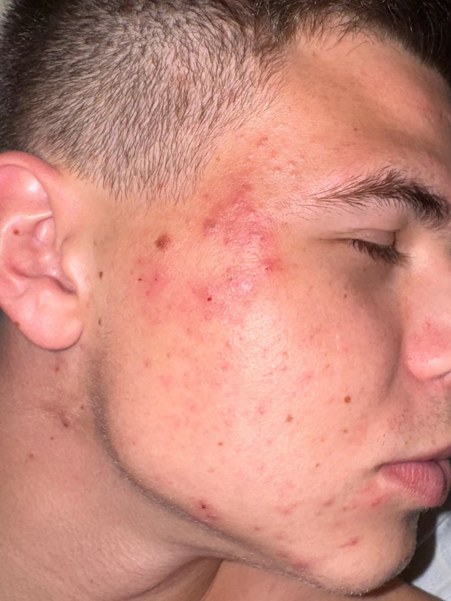 Veido kaukė su LED šviesos terapija, fotoninė, medicininis silikonas
