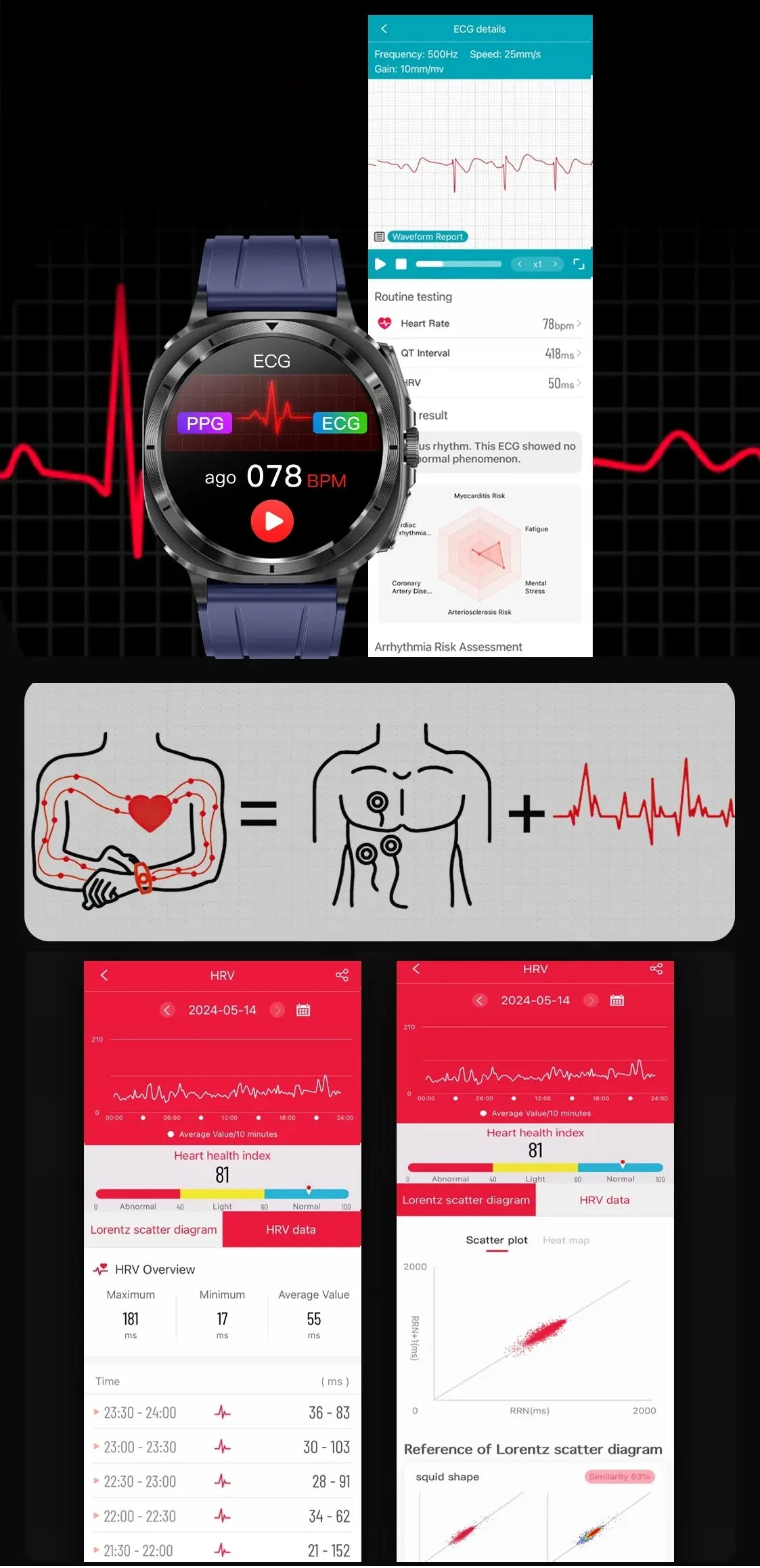 Išmanusis laikrodis su EKG, gliukozės ir kraujospūdžio matavimu